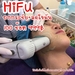 รูปย่อ ULTRA HIFU ยกกระชับหน้าโดยไม่ต้องผ่าตัด ตัวใหม่ลงลึกกว่า Hifu ธรรมดา 4.5 เท่า 100shots 999฿‼️จาก1,900฿ รูปที่1