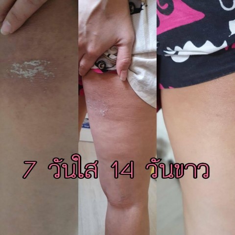 สครับสปาบ้านทุ่ง สครับเพื่อผิวขาว ช่วยปรับผิวกระจ่างใส ให้ผิวเนียนนุ่ม ชุ่มชื่น รูปที่ 5