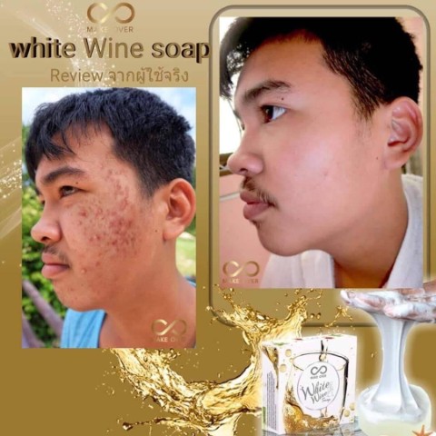 คนไทยต้องได้ใช้สบู่เกรดดีที่สุด White Wine Soap สบู่ไวน์ขาว 14 วันเห็นผล  รูปที่ 1