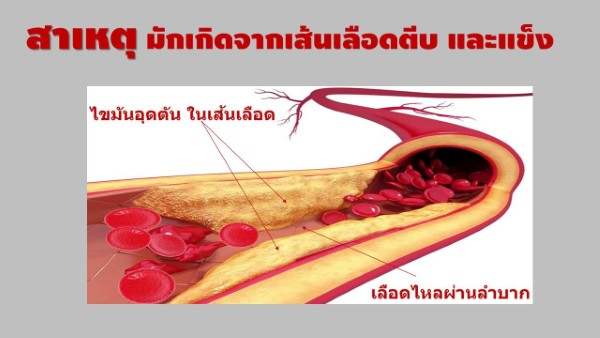 แน่นหน้าอก หายใจเหนื่อย ไม่มีแรง ความดันสูง รีบทานเค.โอ ซิคะ รูปที่ 3