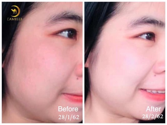 CAMELLE FACIAL SOAP สบู่ล้างหน้าน้ำนมอูฐ คาเมลเล่ มหัศจรรย์ของขวัญจากทะเลทราย รูปที่ 6