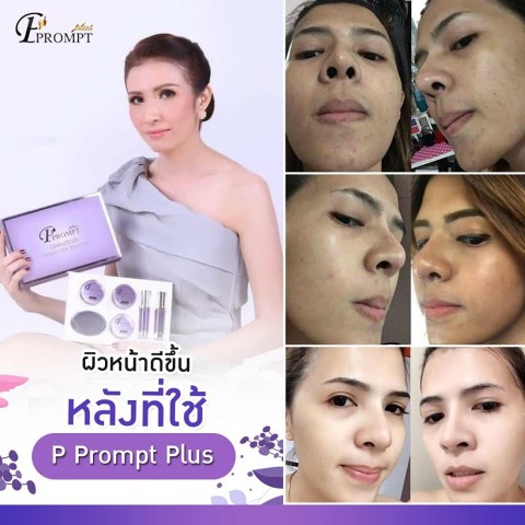 P Prompt Plus หน้าขาวใส ลด ฝ้า กระ สิว หน้าเรียวกระชับ ผิวกระจ่างใสภายใน7-14วัน รูปที่ 5