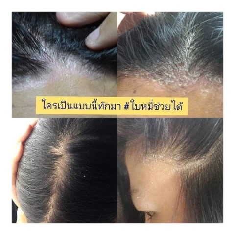 แชมพูและครีมนวดสมุนไพรไทยต้มสด 4YL ASIAN HERBS รูปที่ 6