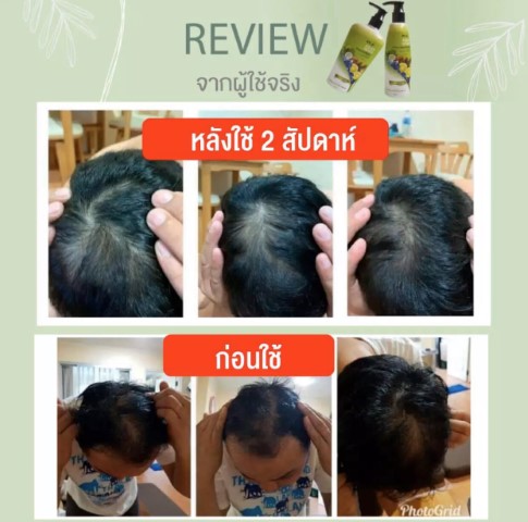 แชมพูและครีมนวดสมุนไพรไทยต้มสด 4YL ASIAN HERBS รูปที่ 5