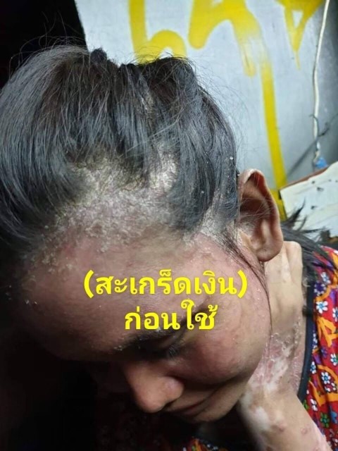 แชมพูและครีมนวดสมุนไพรไทยต้มสด 4YL ASIAN HERBS รูปที่ 7