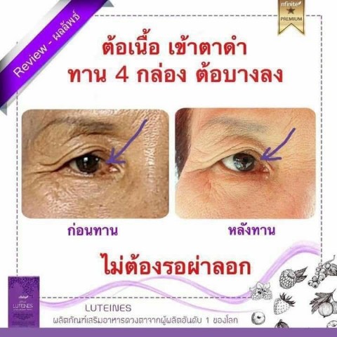 Luteines ลูทีเนส วิตามินบำรุงดวงตา ตอบโจทย์ทุกความต้องการ รูปที่ 6