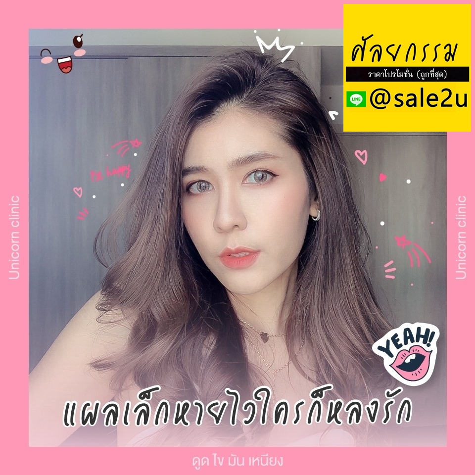 ดูดไขมันเหนียง รูปที่ 5