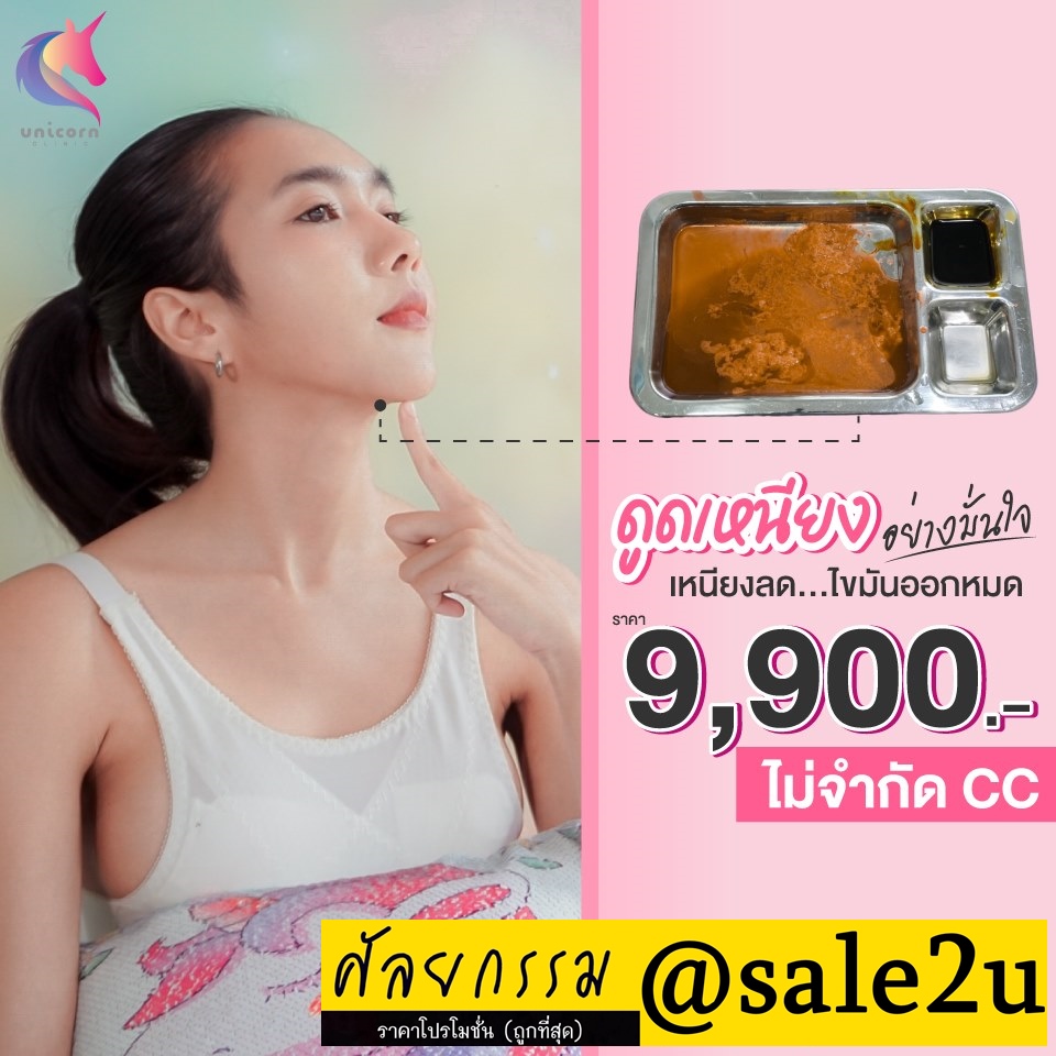 ดูดไขมันเหนียง รูปที่ 6