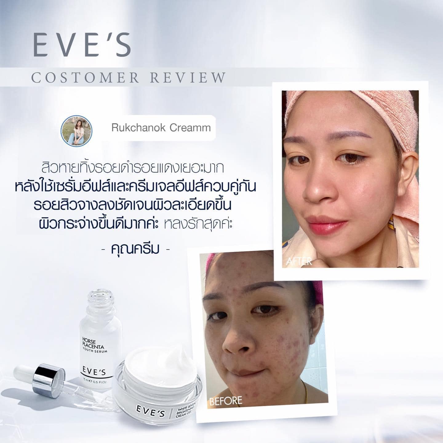 จำหน่ายผลิตภัณฑ์ Eve's ผลิตภัณฑ์บำรุงผิวหน้าและผิวกาย ตอบโจทย์ทุกสภาพผิวหน้า ฝ้า กระ หน้าหมองคล้ำ รูปที่ 5