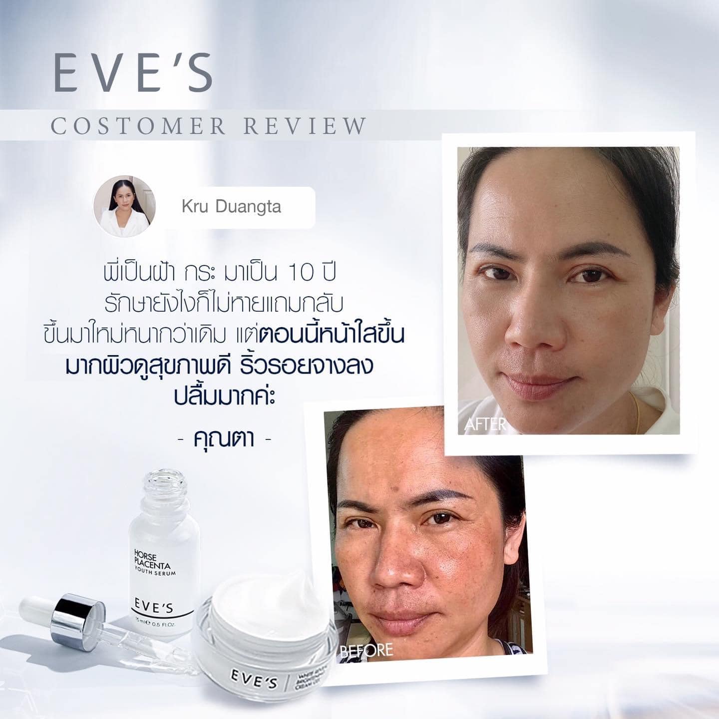 จำหน่ายผลิตภัณฑ์ Eve's ผลิตภัณฑ์บำรุงผิวหน้าและผิวกาย ตอบโจทย์ทุกสภาพผิวหน้า ฝ้า กระ หน้าหมองคล้ำ รูปที่ 6
