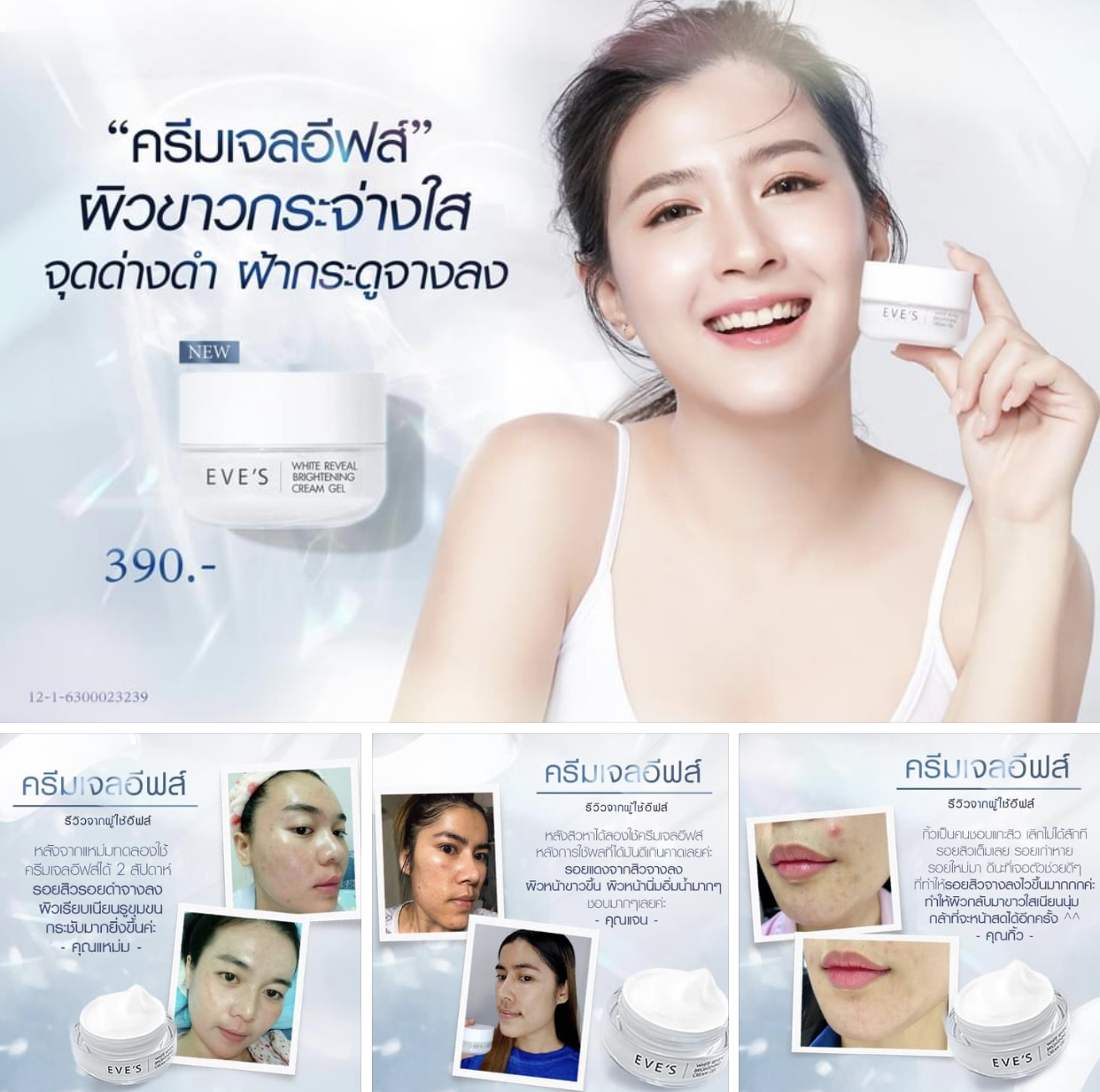 ครีมเจลอีฟส์ ครีมบำรุงผิวหน้าที่กำลังมาแรง การันตีด้วยยอดขายกว่า 500,000 กระปุก พร้อมรีวิวมากมาย ส่งฟรีทั่วประเทศ รูปที่ 4