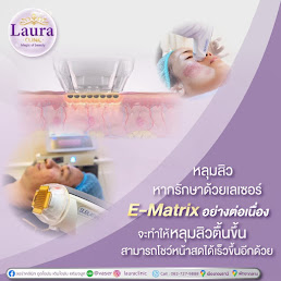 lauraclinic บริการรักษาหลุมสิวด้วยเลเซอร์ E-matrix เป็น ชื่อเครื่อง เลเซอร์รักษาหลุมสิว ที่เป็นที่นิยมที่สุดอันดับ 1 ของเมืองไทย รูปที่ 1