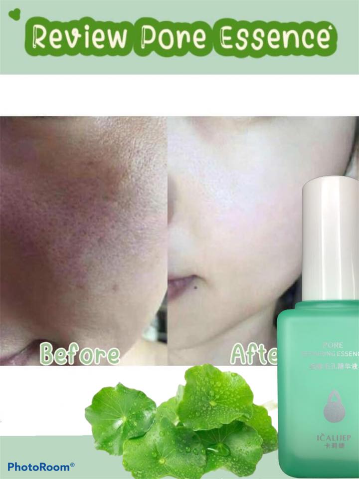 Pore Repairing Essence เซรั่มกระชับรูขุมขน ดังสุดใน Tiktok เซรั่มบำรุงผิว ลดสิวหัวดำ กระชับรูขุมขน แต่งหน้าติดทน ส่งฟรี รูปที่ 6