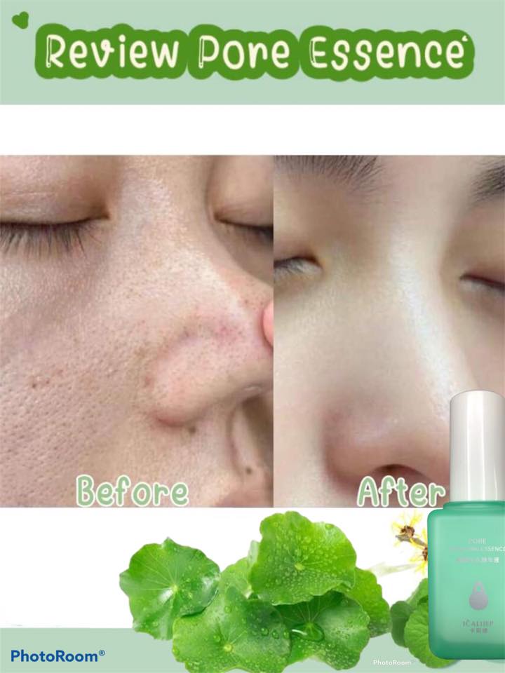 Pore Repairing Essence เซรั่มกระชับรูขุมขน ดังสุดใน Tiktok เซรั่มบำรุงผิว ลดสิวหัวดำ กระชับรูขุมขน แต่งหน้าติดทน ส่งฟรี รูปที่ 5