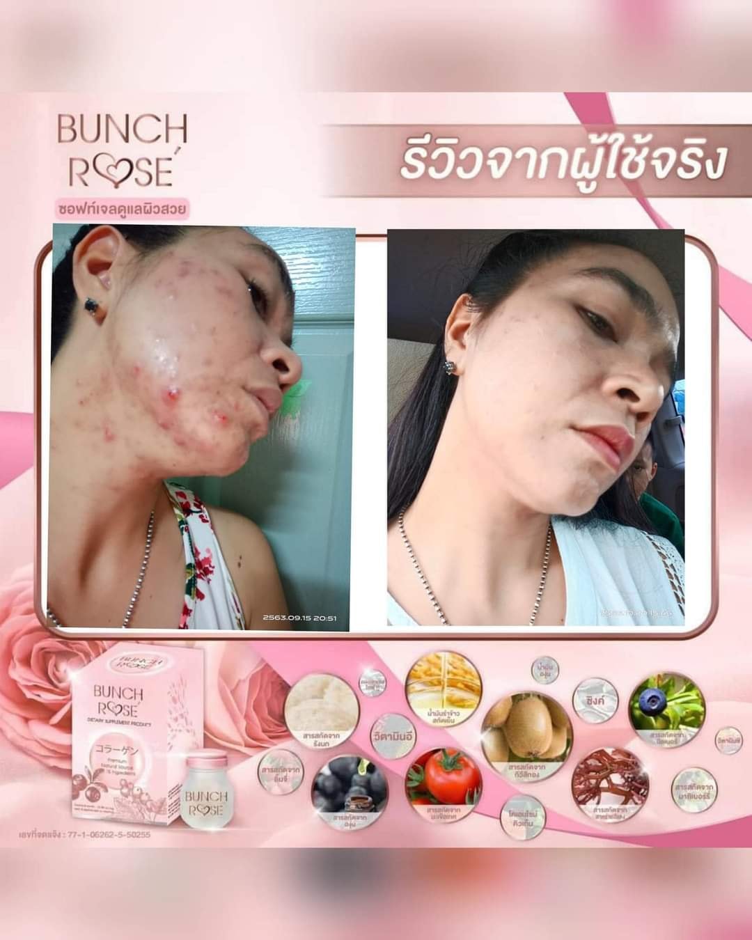 Bunch Rose' บลั้นซ์ โรเซ่ คอลลาเจนเร่งผิวขาว เปล่งปลั่ง มีออร่า ลดริ้วรอย ผิวกระชับ เต่งตึง ผิวฟู นุ่มลื่น จัดส่งฟรีทั่วประเทศ รูปที่ 7