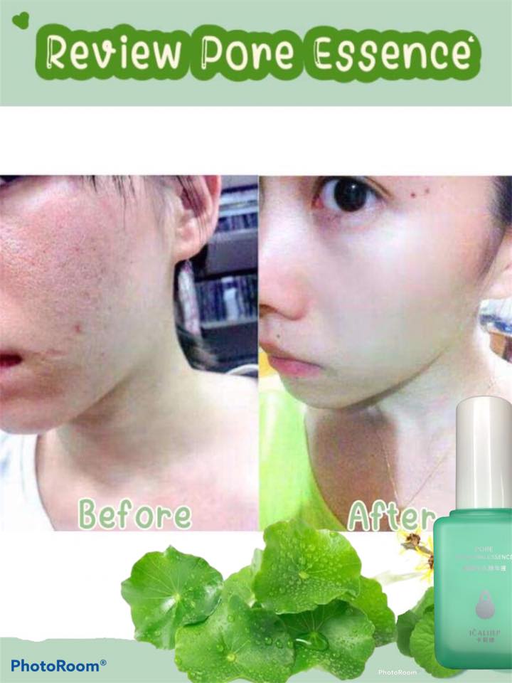 Pore Repairing Essence เซรั่มกระชับรูขุมขน ดังสุดใน Tiktok เซรั่มบำรุงผิว ลดสิวหัวดำ กระชับรูขุมขน แต่งหน้าติดทน ส่งฟรี รูปที่ 7