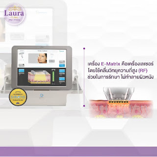 ลอร่าคลินิก บริการทำ subcision (ซับซีชั่น) คือการใช้ปลายเข็ม เข้าไปตัดผังผืดบริเวณใต้ฐานของหลุมสิว ด้วยเครื่อง E-matrix รูปที่ 1