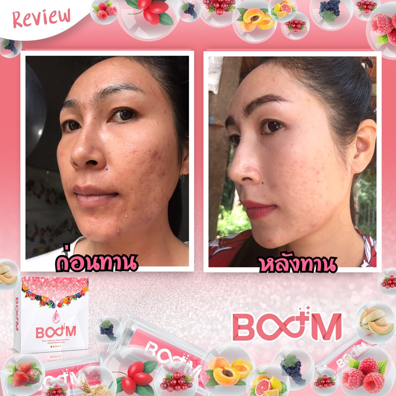 Boom Collagen+ อาหารเสริมดูแลผิว ผม เล็บ กระดูก ให้คุณขาว สุขภาพดี จากภายในสู่ภายนอก รูปที่ 7