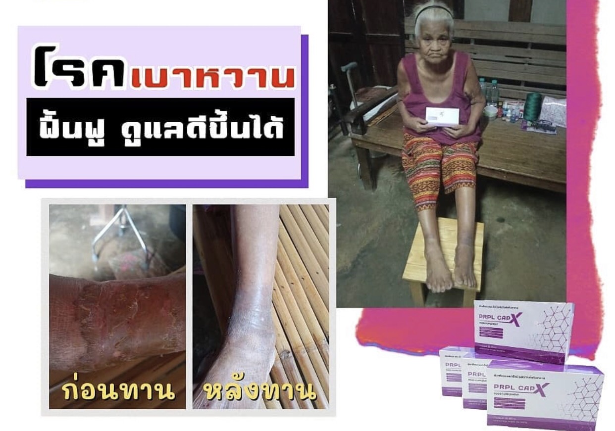 PRPL CAPX รูปที่ 5