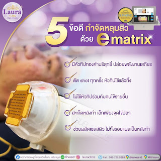 lauraclinic บริการรักษาหลุมสิวด้วยเลเซอร์ E-matrix เป็น ชื่อเครื่อง เลเซอร์รักษาหลุมสิว ที่เป็นที่นิยมที่สุดอันดับ 1 ของเมืองไทย รูปที่ 1