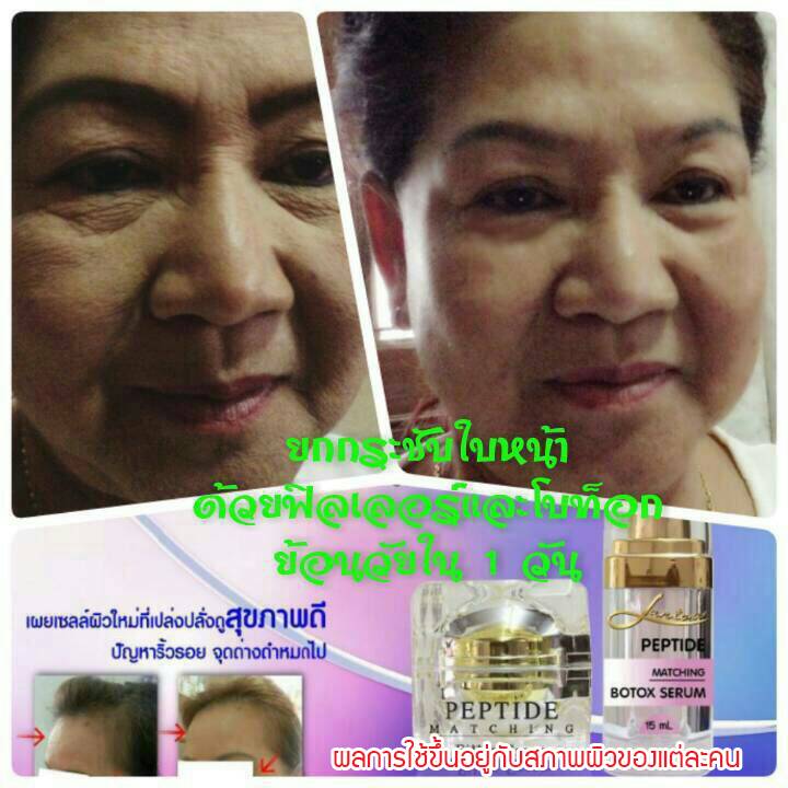 ชุดย้อนวัยBotox serumและFiller cream รูปที่ 2