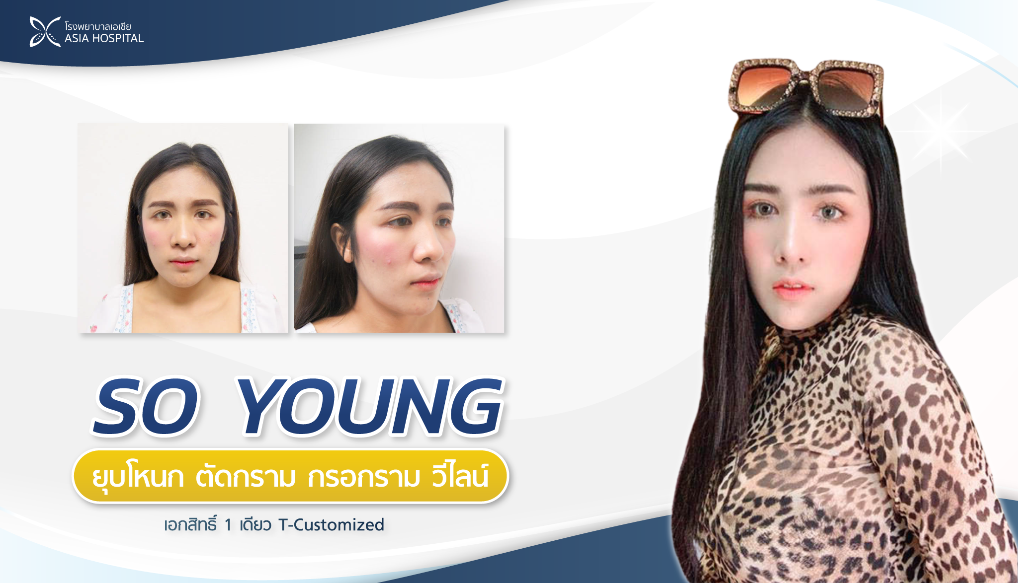 So young ที่เอเซีย รูปที่ 1
