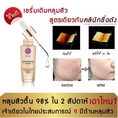 VEVA Repairing Serum เซรั่มเรียกเนื้อหลุมสิว หน้าหลุมรอยสิว รอยดำ รอยแดง เติมเต็มหลุมสิวให้เรียบเนียน