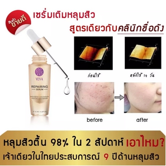 VEVA Repairing Serum เซรั่มเรียกเนื้อหลุมสิว หน้าหลุมรอยสิว รอยดำ รอยแดง เติมเต็มหลุมสิวให้เรียบเนียน รูปที่ 1