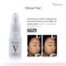 รูปย่อ เซ็ต2ชิ้นสุดคุ้ม  Skinsista V White Booster เซ็ตดูแลผิว สูตร วี ไวท์ 15 ml x2 รูปที่3