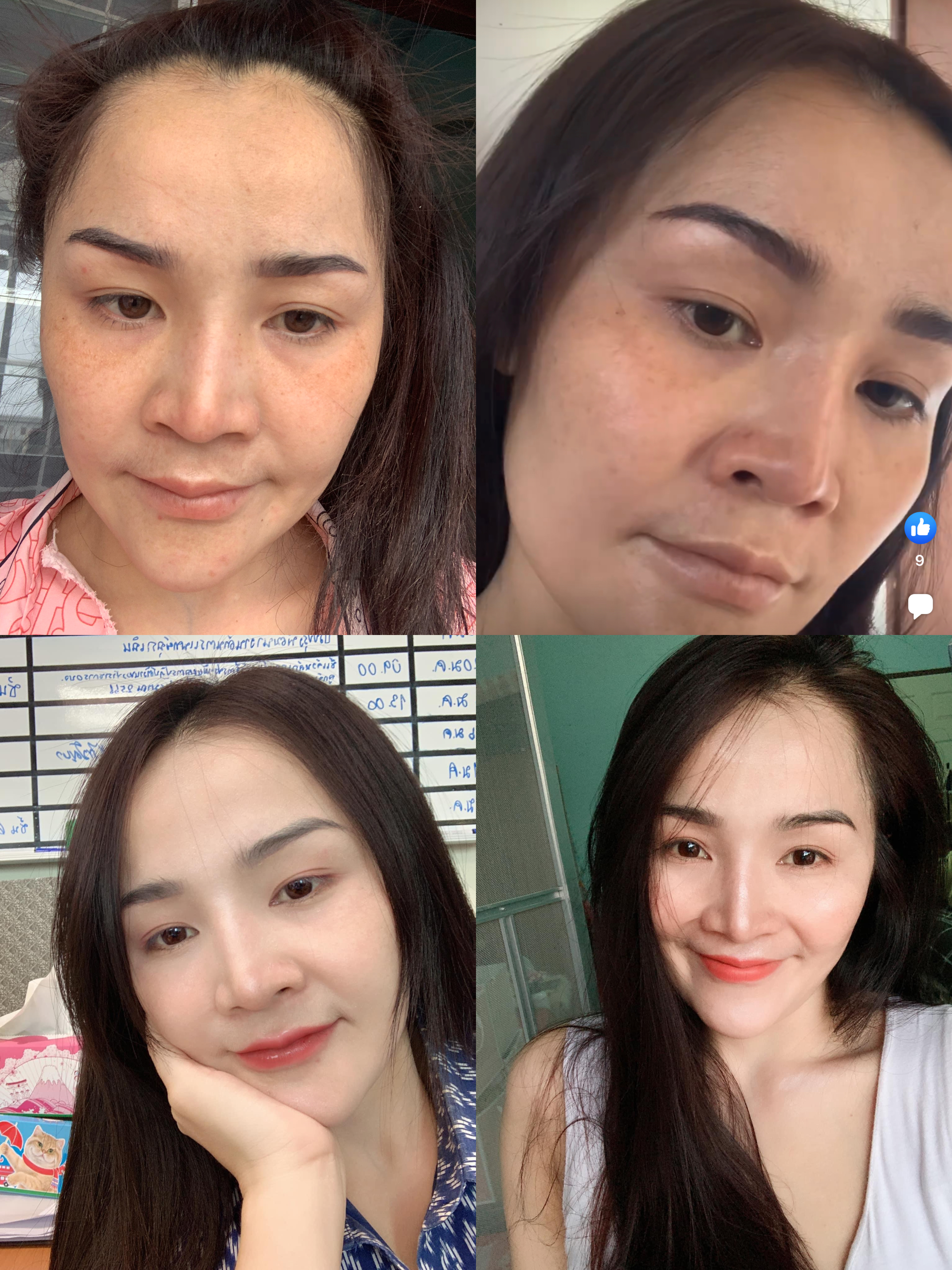 อาหารเสริม บำรุงผิว ผม เล็บ กระดูก รูปที่ 5