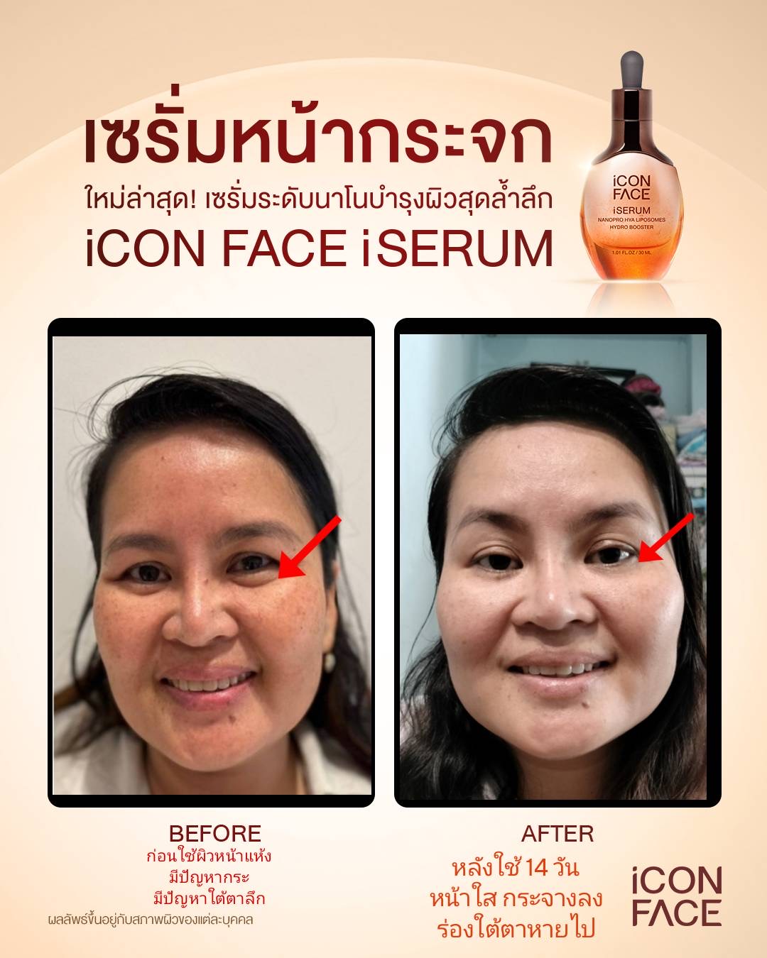 เซรั่มหน้าเด็ก รูปที่ 4