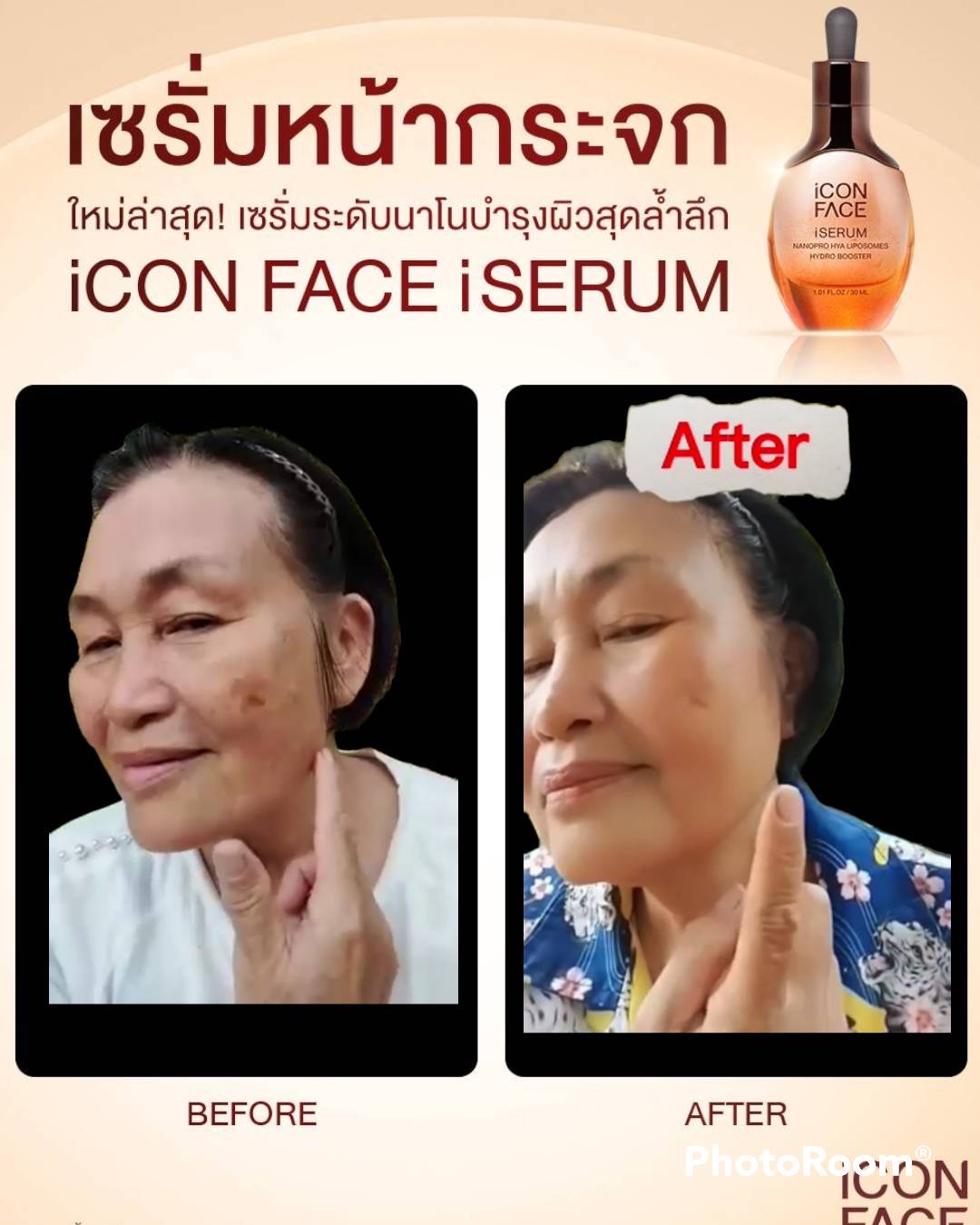 เซรั่มหน้าเด็ก รูปที่ 5