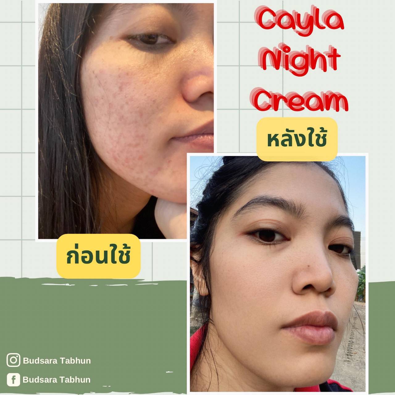 Cayla Night Cream ลดสิว ลดริ้วรอย จุดด่างดำ ผิวหน้ากระจ่างใส ปรับสีผิวให้สม่ำเสมอ ผิวหน้านุ่มชุ่มชื้น  โปรพิเศษซื้อ 1 แถม 1 พร้อมส่งทั่วประเทศ รูปที่ 5