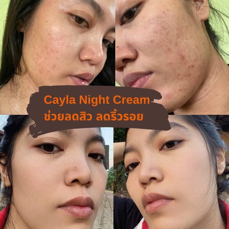 Cayla Night Cream ลดสิว ลดริ้วรอย จุดด่างดำ ผิวหน้ากระจ่างใส ปรับสีผิวให้สม่ำเสมอ ผิวหน้านุ่มชุ่มชื้น  โปรพิเศษซื้อ 1 แถม 1 พร้อมส่งทั่วประเทศ รูปที่ 4