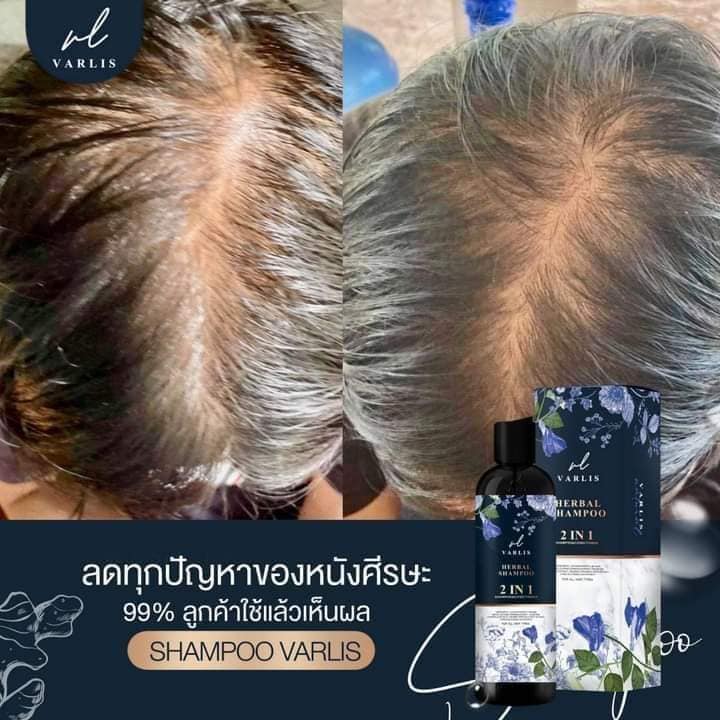 แชมพูวาริส แชมพูสมุนไพรที่ช่วยปัญหาของเส้นผมและหนังศีรษะคืนกลับมามีคุณภาพ ลดผมเสีย ลดผมร่วง  ลดรังแค ลดอาการคัน ขวดละ 350 บาทส่งฟรี รูปที่ 6
