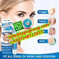 wart remover cream whatsapp/telegram/signal+4407548722515