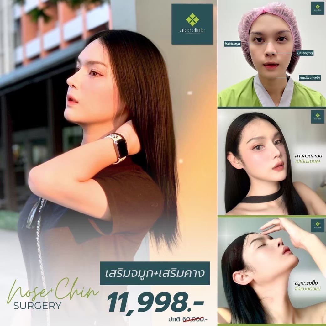 โปรโมชั่นพิเศษ : ALCC Clinic ยืน 1 เรื่องทรง ดูแลแบบเคสต่อเคส สวยได้ในสไตล์ของคุณเอง รูปที่ 3