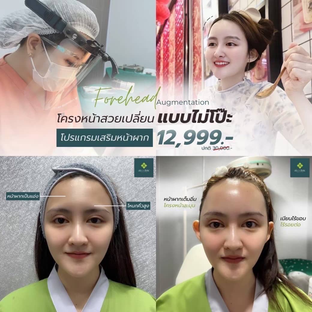 โปรโมชั่นพิเศษ : ALCC Clinic ยืน 1 เรื่องทรง ดูแลแบบเคสต่อเคส สวยได้ในสไตล์ของคุณเอง รูปที่ 4
