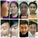 รูปย่อ เซรั่มลอกฝ้า รูปที่2