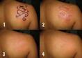 Tattoo remover cream or gel in Cape Town+27 81 850 2816 