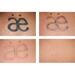 รูปย่อ Tattoo remover cream or gel in Cape Town+27 81 850 2816  รูปที่2