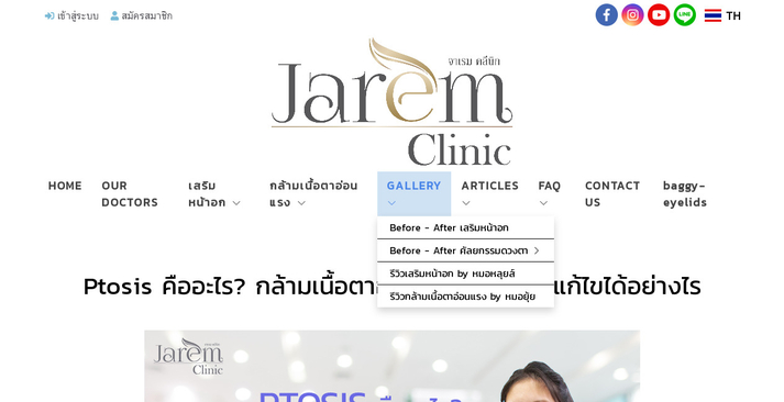 Jarem Clinic กล้ามเนื้อตาอ่อนแรง รูปที่ 1